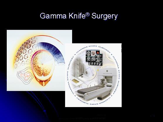 gamma knife
